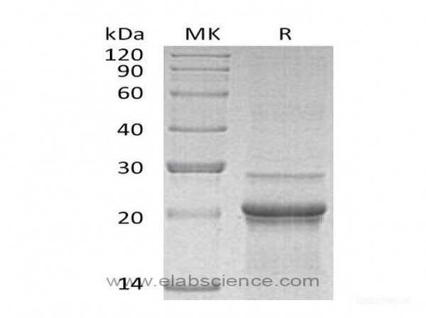 Interleukin-6/IL-6Protein (recombinant mouse)