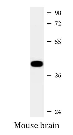 Anti-Aldolase C, clone 859CT9.5.3