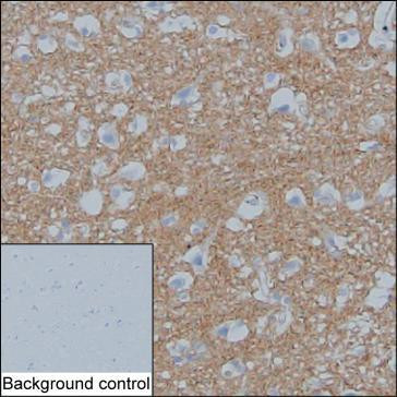 Anti-alpha Synuclein