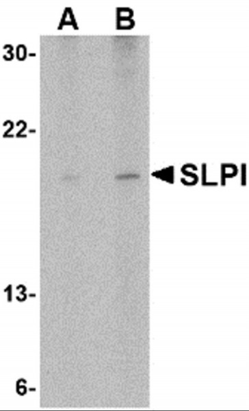 Anti-SLPI
