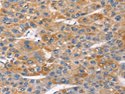 Anti-SNTA1