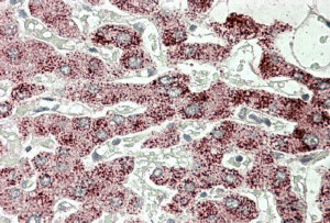 Anti-Sterol carrier protein 2, Internal