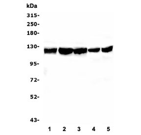 Anti-BUB1B / BubR1