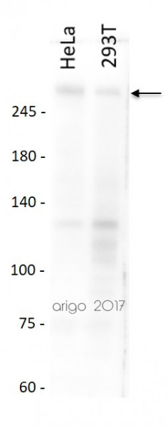 Anti-BRCA1