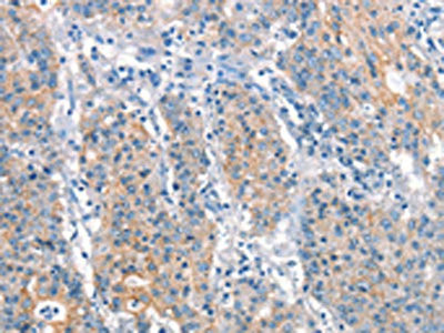 Anti-ARHGEF11