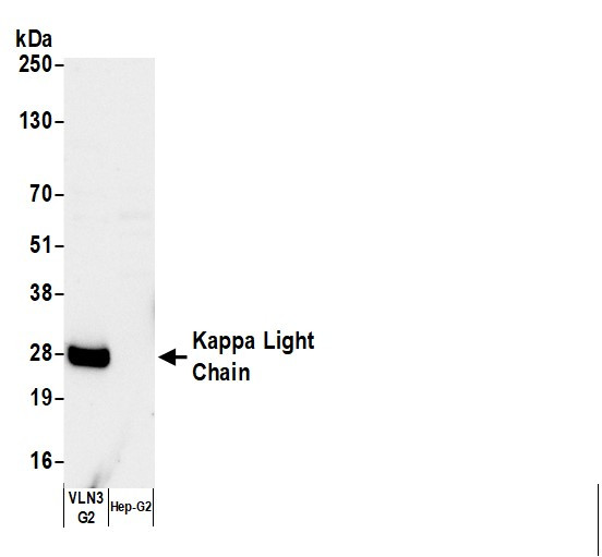 Anti-Human Kappa Light Chain