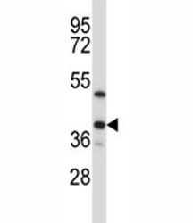 Anti-ERCC1