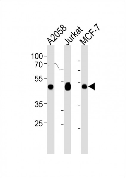 Anti-EBP1