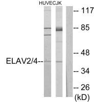 Anti-ELAVL2/ELAVL4