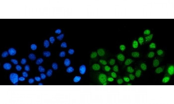 Anti-DYNLL1 / Dynein light chain 1