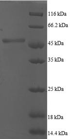 ADP-ribosylation factor 5 (ARF5), human, recombinant