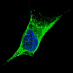 Anti-Vimentin