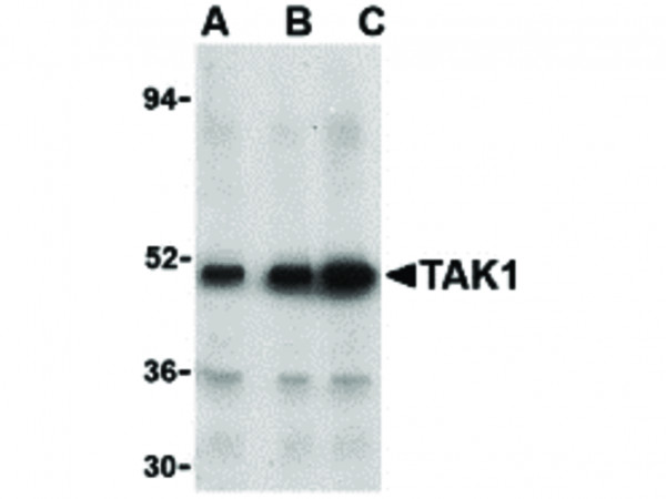 Anti-TAK1