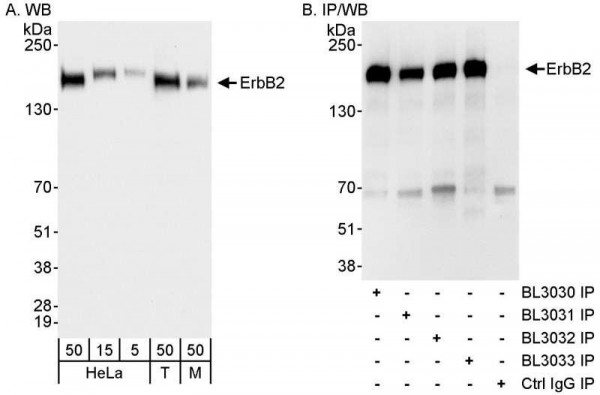 Anti-ErbB2