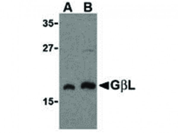 Anti-GBL
