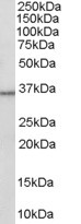 Anti-HSD11B1 / HDL, C-terminal