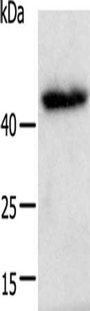 Anti-E2F2