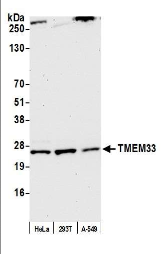 Anti-TMEM33