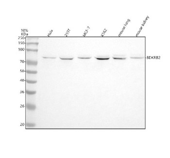 Anti-BDKRB2 / Bradykinin receptor B2, clone AFAG-2