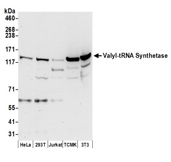 Anti-Valyl-tRNA Synthetase/VARS