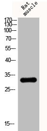 Anti-PPP1R1B