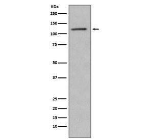 Anti-Retinoblastoma / Rb1, clone BHC-18