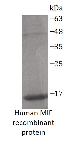 Human MIF recombinant protein (His-tagged)