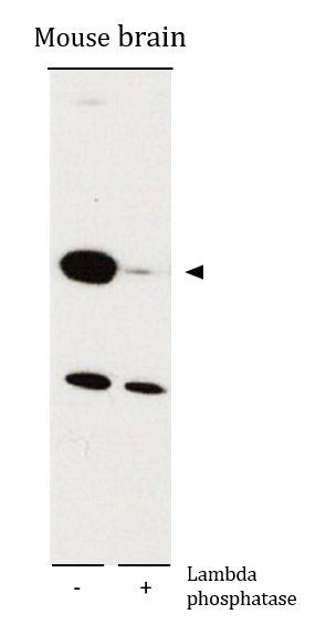 Anti-phospho-DPYSL2 / CRMP2 (Ser522)