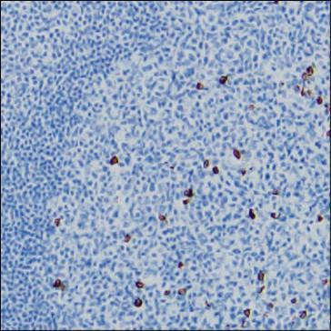 Anti-Human IgG3