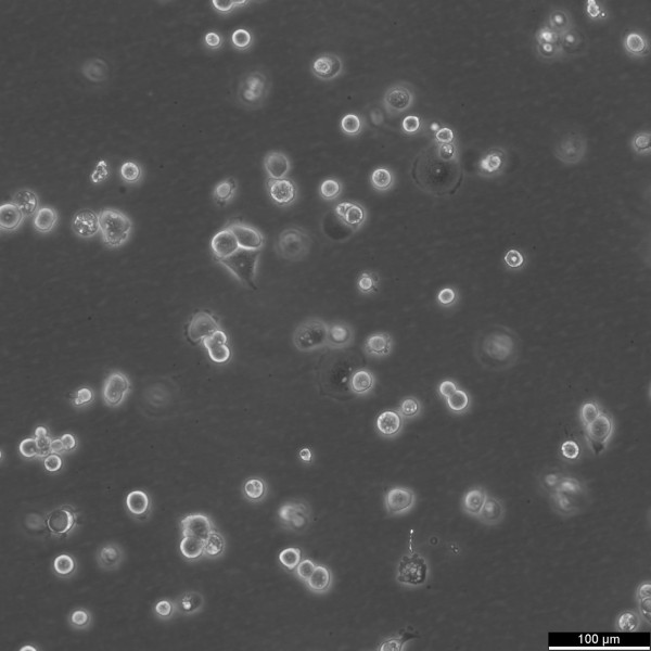 OVCAR-3 Cells