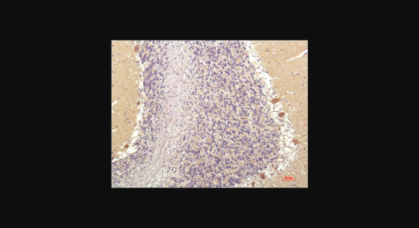 Anti-SGK1 (4D12), monoclonal