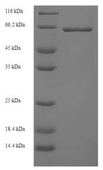 Pyruvate kinase isozymes R/L (PKLR), human, recombinant